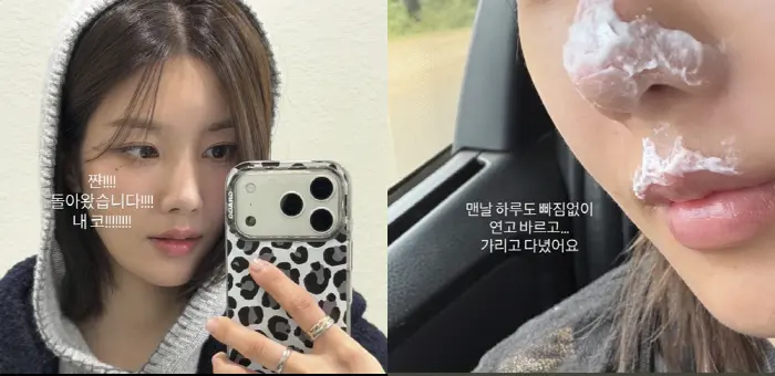权恩妃公开面部及嘴唇烧伤特写照片,皮肤红肿结痂