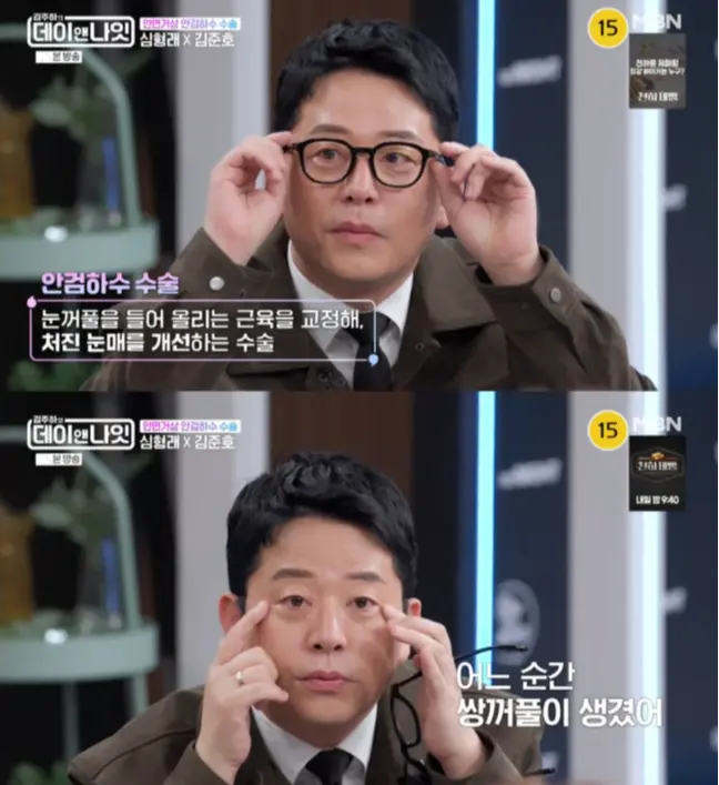 沈炯来在节目中讲述为了饰演英九角色进行面部拉皮手术的经历