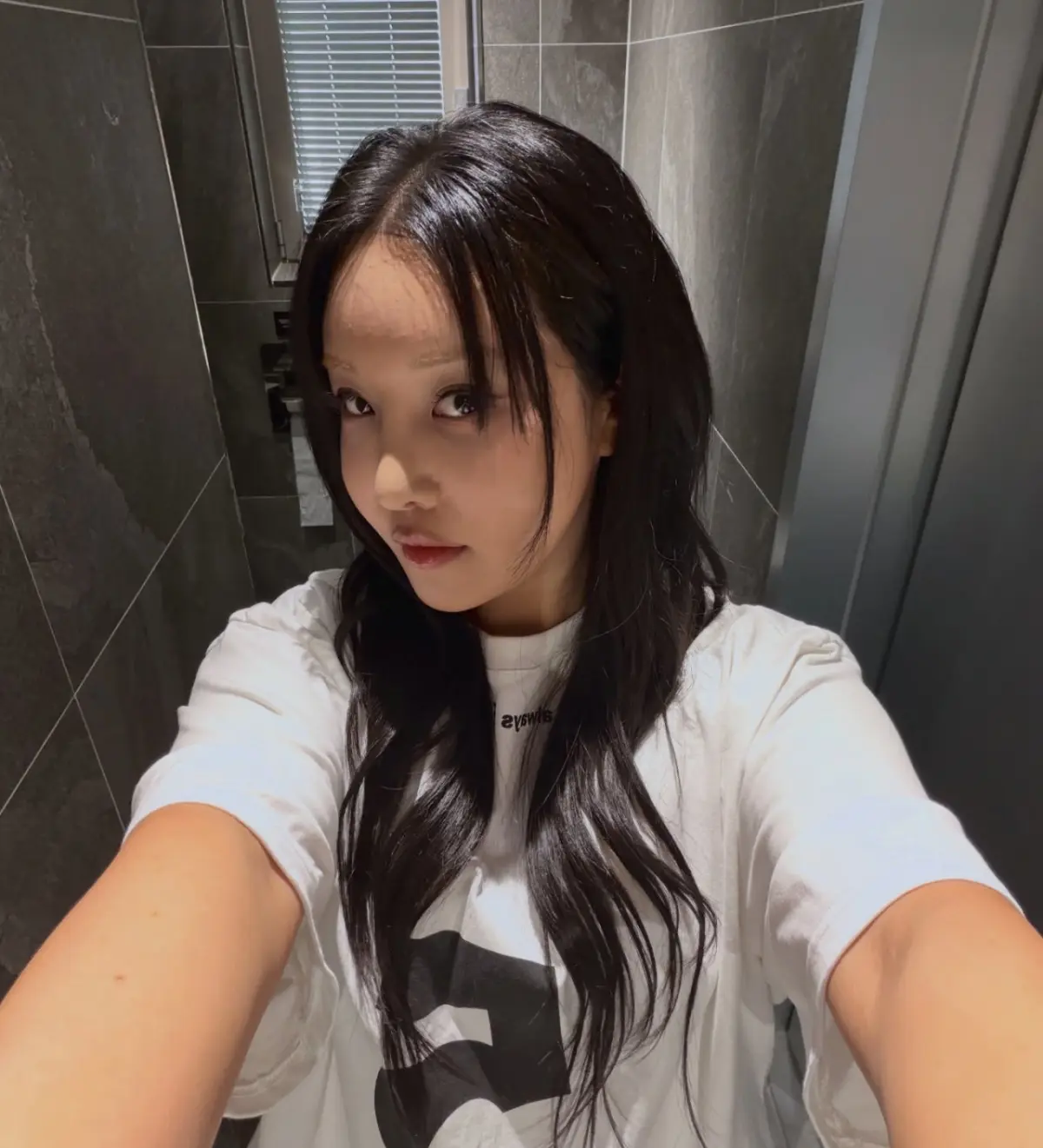 Ralral整容术后11天恢复照,眼底与鼻子消肿明显,妆容精致