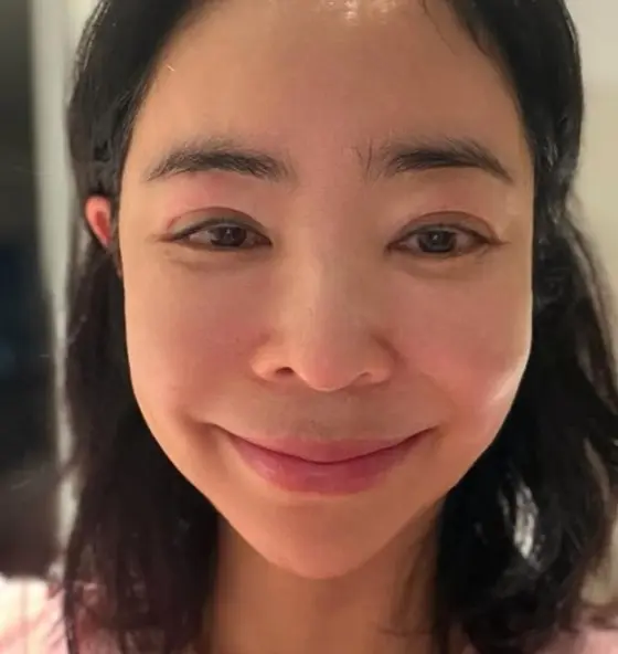 李惠英肺癌术后近况引担忧：洛杉矶办展致淋巴循环受阻，面部浮肿仍乐观面对