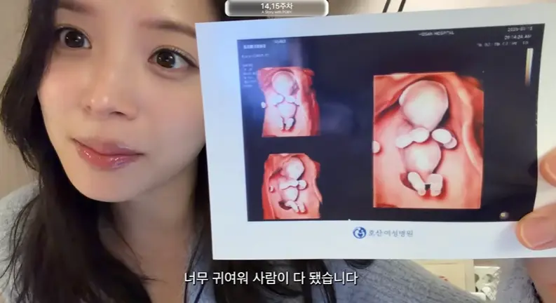 金智英在YouTube频道分享孕14至15周的日常与消肿管理画面